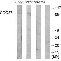Western blot analysis of extracts from HUVEC cells, HepG2 cells and COLO205 cells, using H-NUC antibody.