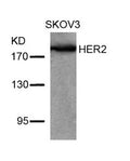 Western blot analysis of extracts from SKOV3 cells using HER2(Ab-877) Antibody.