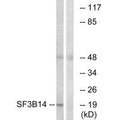 Western blot analysis of extracts from HepG2 cells, using SF3B14 antibody.