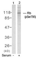 Western blot analysis of extracts from K562 cells untreated(lane 1) or treated with serum(lane 2) using Rb(Phospho-Ser795) Antibody.