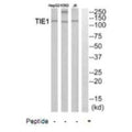 Western blot analysis of extracts from HepG2 cells, K562 cells and Jurkat cells, using TIE1 antibody.