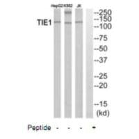 Western blot analysis of extracts from HepG2 cells, K562 cells and Jurkat cells, using TIE1 antibody.