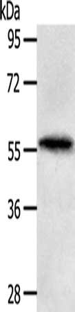 Gel: 10%SDS-PAGE, Lysate: 40 ug, Lane: Human fetal liver tissue, Primary antibody: CSB-PA202607(MATN4 Antibody) at dilution 1/200, Secondary antibody: Goat anti rabbit IgG at 1/8000 dilution, Exposure time: 30 seconds