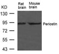 Western blot analysis of extract from Rat brain and Mouse brain Tissue using Periostin Antibody
