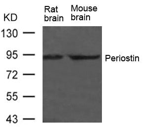 Western blot analysis of extract from Rat brain and Mouse brain Tissue using Periostin Antibody