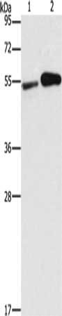 Gel: 10%SDS-PAGE, Lysate: 40 ug, Lane 1-2: Raji cells, U937 cells, Primary antibody: CSB-PA203862(FSCN1 Antibody) at dilution 1/200, Secondary antibody: Goat anti rabbit IgG at 1/8000 dilution, Exposure time: 40 seconds