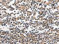 The image on the left is immunohistochemistry of paraffin-embedded Human tonsil tissue using CSB-PA204522(INHA Antibody) at dilution 1/120, on the right is treated with fusion protein. (Original magnification: ×200)