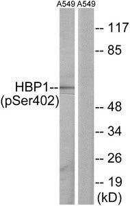 Western blot analysis of extracts from A549 cells, treated with PMA (125ng/ml, 30mins), using HBP1 (Phospho-Ser402) antibody. The lane on the right is treated with the synthesized peptide.