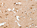 The image on the left is immunohistochemistry of paraffin-embedded Human brain tissue using CSB-PA204993(CAPG Antibody) at dilution 1/40, on the right is treated with fusion protein. (Original magnification: ×200)