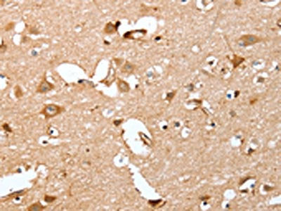 The image on the left is immunohistochemistry of paraffin-embedded Human brain tissue using CSB-PA204993(CAPG Antibody) at dilution 1/40, on the right is treated with fusion protein. (Original magnification: ×200)