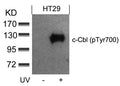 Western blot analysis of extracts from HT29 cells untreated or treated with UV using c-Cbl(phospho-Tyr700) Antibody.