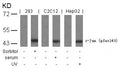 Western blot analysis of extracts from sorbitol-treated 293, Serum-treated C2C12 and UV-treated HepG2 cells using c-Jun(Phospho-Ser243) Antibody.