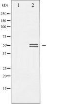 Western blot analysis of GSK3 alpha/beta expression in TNF-a treated 293 whole cell lysates,The lane on the left is treated with the antigen-specific peptide.