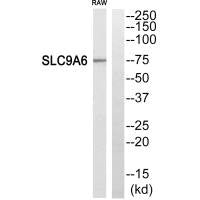 Western blot analysis of extracts from RAW264.7 cells,using SLC9A6 antibody.