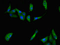 Immunofluorescent analysis of Hela cells using CSB-PA20629A0Rb at dilution of 1:100 and Alexa Fluor 488-congugated AffiniPure Goat Anti-Rabbit IgG(H+L)