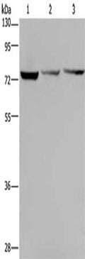 Gel: 8%SDS-PAGE, Lysate: 40 ug, Lane 1-3: Hela cells, SKOV3 cells, Jurkat cells, Primary antibody: CSB-PA206501(KLHL9 Antibody) at dilution 1/300, Secondary antibody: Goat anti rabbit IgG at 1/8000 dilution, Exposure time: 1 minute