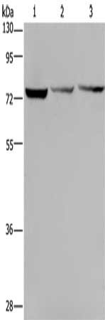 Gel: 8%SDS-PAGE, Lysate: 40 ug, Lane 1-3: Hela cells, SKOV3 cells, Jurkat cells, Primary antibody: CSB-PA206501(KLHL9 Antibody) at dilution 1/300, Secondary antibody: Goat anti rabbit IgG at 1/8000 dilution, Exposure time: 1 minute