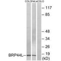 Western blot analysis of extracts from COLO cells and HeLa cells, using BRP44L antibody.