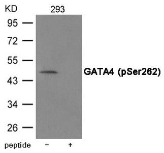 Western blot analysis of extracts from 293 cells using GATA4 (Phospho-Ser262) Antibody.The lane on the right is treated with the antigen-specific peptide.