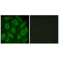 Immunofluorescence analysis of HeLa cells, using CDH23 antibody.