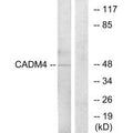 Western blot analysis of extracts from RAW264.7 cells, using CADM4 antibody.