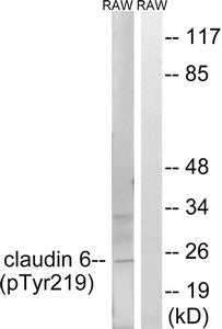 Western blot analysis of extracts from RAW264.7 cells treated with UV using Claudin 6 (Phospho-Tyr219) Antibody.The lane on the right is treated with the antigen-specific peptide.