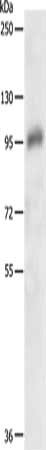 Gel: 8%SDS-PAGE, Lysate: 40 ug, Lane: Hela cells, Primary antibody: CSB-PA208206(PDGFRB Antibody) at dilution 1/200, Secondary antibody: Goat anti rabbit IgG at 1/8000 dilution, Exposure time: 90 seconds