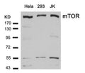 Western blot analysis of extracts from Hela, 293 and JK cells using mTOR(Ab-2448) Antibody.