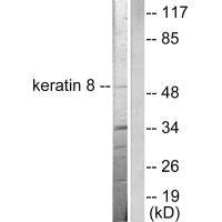 Western blot analysis of extracts from SKOV3 cells, using Keratin 8 antibody.