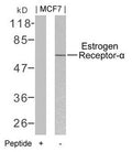 Western blot analysis of extracts from MCF7 cells using Estrogen Receptor-a(Ab-106) Antibody and the same antibody preincubated with blocking peptide.