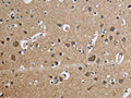 The image is immunohistochemistry of paraffin-embedded Human brain tissue using CSB-PA209356(CYCS Antibody) at dilution 1/50. (Original magnification: ×200)