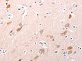 The image on the left is immunohistochemistry of paraffin-embedded Human brain tissue using CSB-PA209818(C1QTNF6 Antibody) at dilution 1/30, on the right is treated with fusion protein. (Original magnification: ×200)