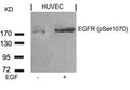 Western blot analysis of extracts from HUVEC cells untreated or treated with EGF using EGFR(Phospho-Ser1070) Antibody.