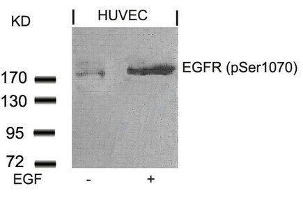 Western blot analysis of extracts from HUVEC cells untreated or treated with EGF using EGFR(Phospho-Ser1070) Antibody.