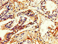 Immunohistochemistry of paraffin-embedded human lung tissue using CSB-PA21029A0Rb at dilution of 1:100