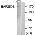 Western blot analysis of extracts from LOVO cells, using BAF250B antibody.