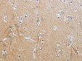 The image on the left is immunohistochemistry of paraffin-embedded Human brain tissue using CSB-PA210767(TNFRSF11B Antibody) at dilution 1/20, on the right is treated with fusion protein. (Original magnification: ×200)