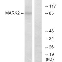 Western blot analysis of extracts from COS-7 cells, using MARK2 antibody.