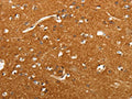 The image on the left is immunohistochemistry of paraffin-embedded Human brain tissue using CSB-PA211509(SLC4A4 Antibody) at dilution 1/50, on the right is treated with fusion protein. (Original magnification: ×200)
