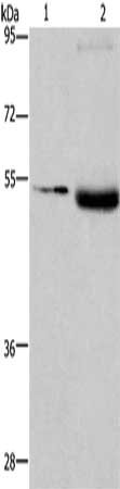 Gel: 8%SDS-PAGE, Lysate: 40 ug, Lane 1-2: PC3 cells, human testis tissue, Primary antibody: CSB-PA211604(LPCAT4 Antibody) at dilution 1/400, Secondary antibody: Goat anti rabbit IgG at 1/8000 dilution, Exposure time: 8 minutes