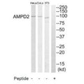 Western blot analysis of extracts from HeLa cells, NIH-3T3 cells and COLO205 cells, using AMPD2 antibody.