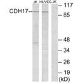 Western blot analysis of extracts from Jurkat cells and HUVEC cells, using CDH17 antibody.