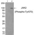 Western blot analysis of extracts from JK cells (Lane 2), using JAK2 (Phospho-Tyr570) Antibody. The lane on the left is treated with antigen-specific peptide.
