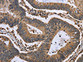 GADD45B Antibody – Figure 1 of 2