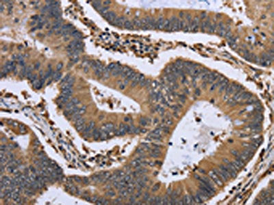 GADD45B Antibody – Figure 1 of 2