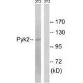 Western blot analysis of extracts from 3T3 cells, using PYK2 (Ab-579) antibody.