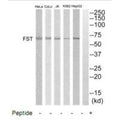 Western blot analysis of extracts from HepG2, K562, COLO205, Jurkat and HeLa cells, using FST antibody.
