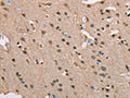 The image on the left is immunohistochemistry of paraffin-embedded Human brain tissue using CSB-PA213215(SERPINA1 Antibody) at dilution 1/45, on the right is treated with fusion protein. (Original magnification: ×200)