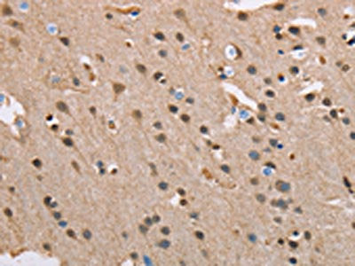 The image on the left is immunohistochemistry of paraffin-embedded Human brain tissue using CSB-PA213215(SERPINA1 Antibody) at dilution 1/45, on the right is treated with fusion protein. (Original magnification: ×200)