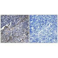 Immunohistochemistry analysis of paraffin-embedded human thymus gland tissue using Collagen XIX α1 antibody.